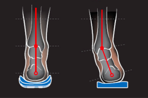 ortopeedilised jalatsid